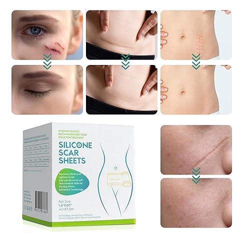 DermaEase™ | Silicone Scar Gel Sheet - Image 3