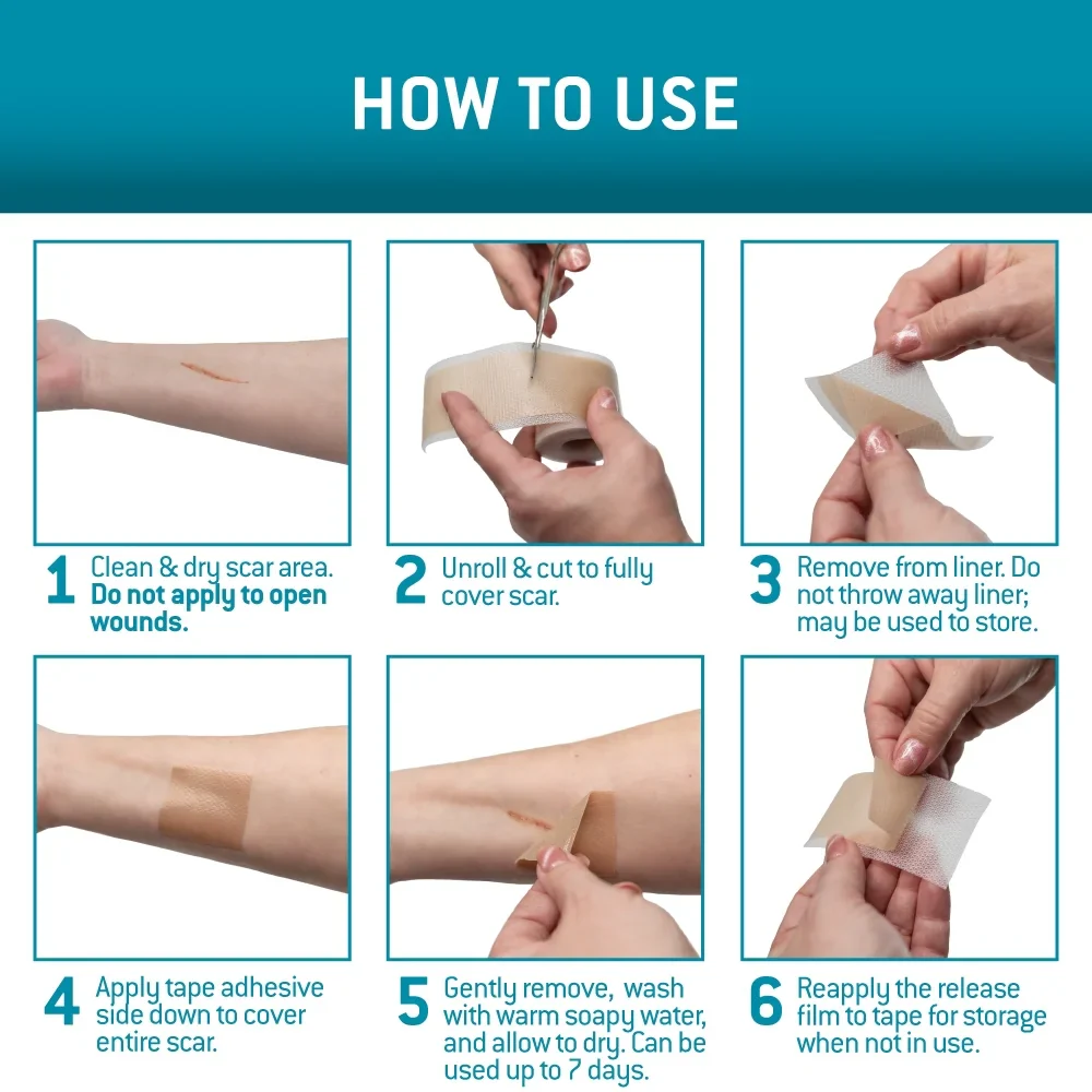 DermaEase™ | Silicone Scar Gel Sheet - Image 4