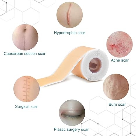 DermaEase™ | Silicone Scar Gel Sheet - Image 5
