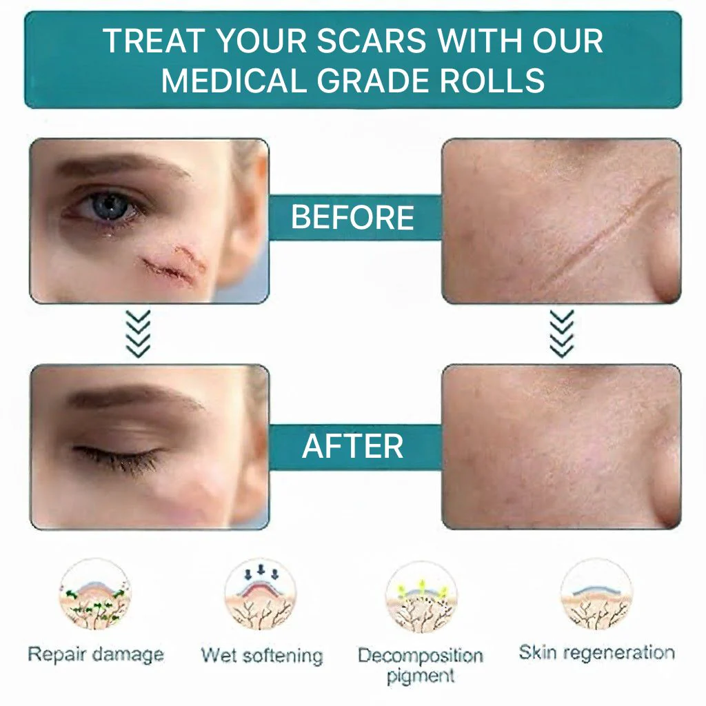 DermaEase™ | Silicone Scar Gel Sheet - Image 6