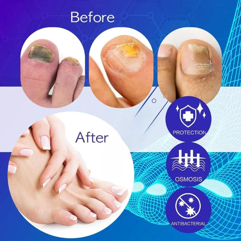 FungalAid™ – Anti-Fungal & Anti-Odor Spray | Prevents Nail & Foot Infections - Image 4